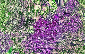 AP 154A1